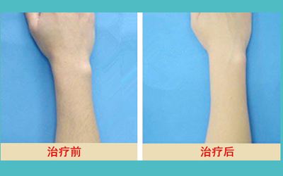 最新發(fā)布！匯總?cè)箩t(yī)院名單，解決牙齒問(wèn)題待了整整一年