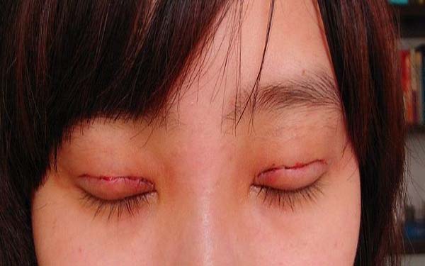 成都整形醫(yī)院修復(fù)隆鼻排行榜：前五強(qiáng)醫(yī)療機(jī)構(gòu)值得推薦！