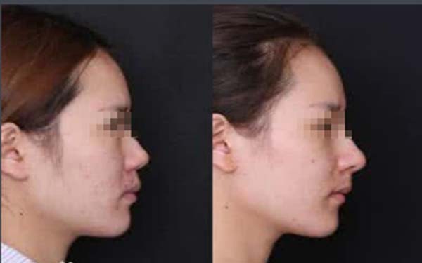 惠州市區(qū)最受好評的整形醫(yī)院有哪些？推薦這4家在市內(nèi)名聲鵲起的醫(yī)院