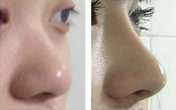 杭州口碑最佳的整形醫(yī)院盤點！匯總七家頂級醫(yī)療機構，專注為您帶來品質醫(yī)美服務