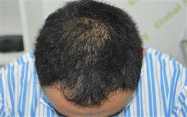 打造整齊健康的牙齒，推薦這幾家成都口腔醫(yī)院