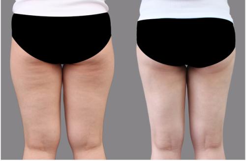 廣西整形醫(yī)院精選！當(dāng)紅top6醫(yī)院名單曝光，人氣首選聚焦簡介