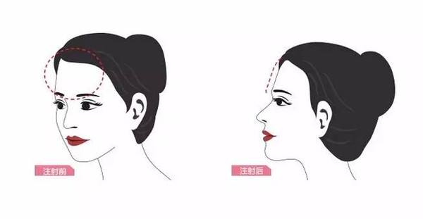 成都哪些醫(yī)院可進(jìn)行磨骨手術(shù)【三家鑒定】