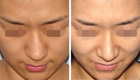 杭州磨骨(下頜角)整形頂級醫(yī)療設(shè)施匯總前五