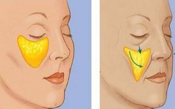 揭秘四川地區(qū)優(yōu)質(zhì)隆鼻醫(yī)院Top4，大多為公立醫(yī)療機(jī)構(gòu)！