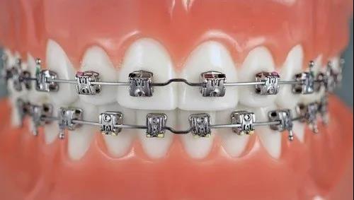 昆明頂級(jí)牙科醫(yī)院排行榜出爐！整牙專(zhuān)家力壓群雄，技術(shù)高超