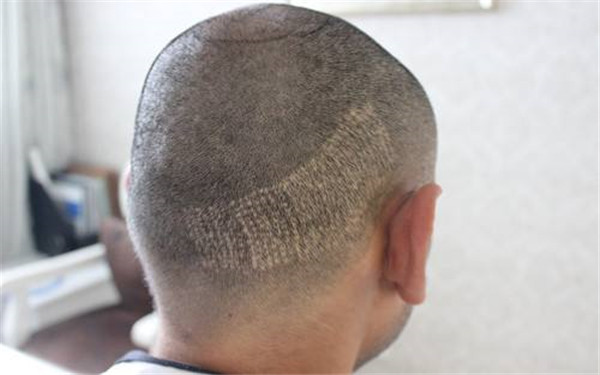 昆明市公立醫(yī)院整形科綜合比較：星耀、甘美、昆醫(yī)附屬等入圍前四！速查！