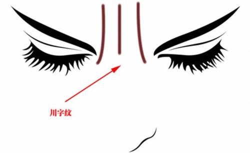 成都雙眼皮修復手術：五家性價比高、技術好的醫(yī)院推薦