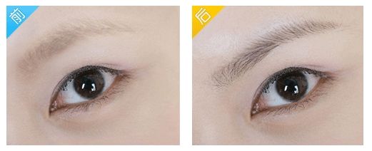 浙江哪個(gè)地方可以有效治療疤痕？?jī)?yōu)質(zhì)機(jī)構(gòu)入圍省內(nèi)六地8家！