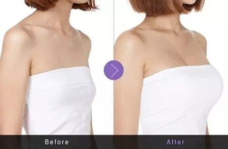 沈陽磨骨瘦臉五大頂級技術(shù)推薦，這幾家技術(shù)最受關(guān)注！