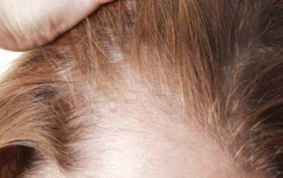 洛陽最受歡迎的雙眼皮整形醫(yī)院排行榜！預(yù)算驚喜！