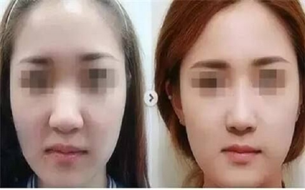 濰坊整形醫(yī)院推薦！這三家綜合評(píng)價(jià)絕對(duì)出眾