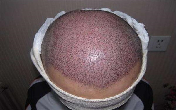 深圳祛除黑眼圈的五家整形醫(yī)院排名單公布！風(fēng)格多樣，技術(shù)獨(dú)特！價(jià)目表內(nèi)幕，助你選對(duì)醫(yī)院！