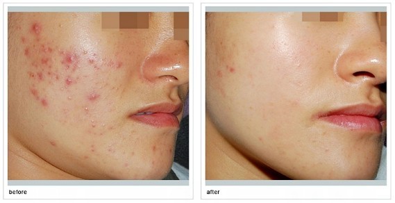 煙臺市牙齒種植最佳醫(yī)院匯總：哪家醫(yī)院值得選擇？一文速覽享知！