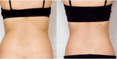 湖州湖人眼袋醫(yī)院TOP5，曙光與唯美齊爭魁！