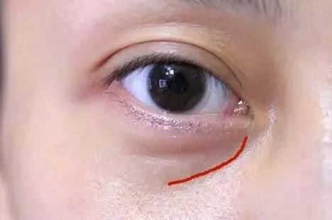 沈陽(yáng)哪家醫(yī)院做雙眼皮好？推薦這幾家，讓你的雙眼美麗動(dòng)人起來(lái)！