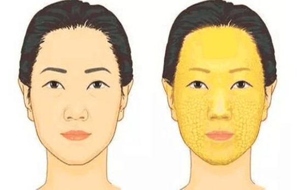 滄州治療疤痕的正規(guī)醫(yī)院推薦：專業(yè)科技祛疤，效果顯著！點擊了解！