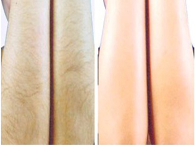 石家莊保妥適肉毒素注射醫(yī)生