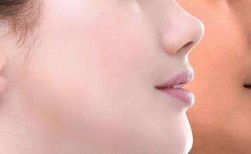 昆明點陣去老年斑醫(yī)生