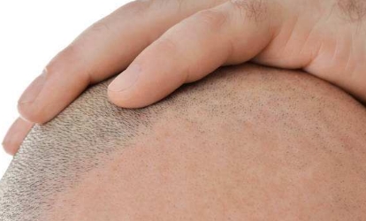 深圳最熱門(mén)的拉皮手術(shù)醫(yī)生推薦！值得信賴(lài)的十大醫(yī)師名單發(fā)布！