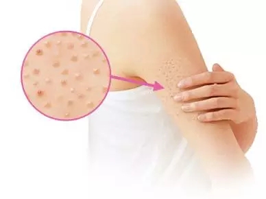 浙江哪家整形醫(yī)院最受歡迎？浙江前五強(qiáng)推薦！