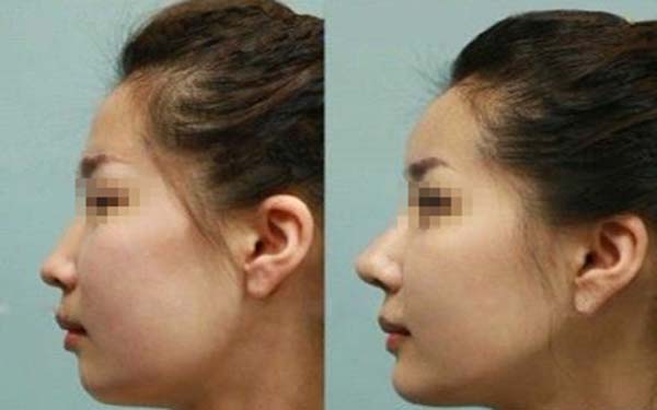 深圳頂級整容醫(yī)院排行榜發(fā)布！整形美容醫(yī)院報價明細(xì)表最新更新