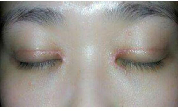 沈陽(yáng)超贊的私密緊致術(shù)醫(yī)院匯總排名前十，曙光、美萊技術(shù)對(duì)比分析，各有獨(dú)特魅力！