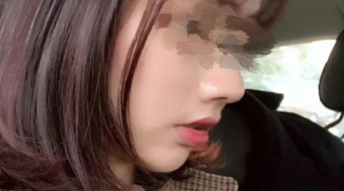 煙臺(tái)雙眼皮整形醫(yī)院排名前五名揭曉！用戶口碑持續(xù)贊賞