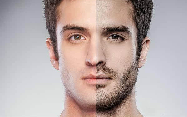 河南整形醫(yī)院的最佳選擇，讓您告別煩惱的去皮脂腺痣解決方案！六大推薦醫(yī)院匯總