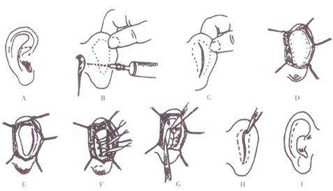深圳眼部整形業(yè)內(nèi)杰出醫(yī)生盤點！錯過可惜，快來查看！
