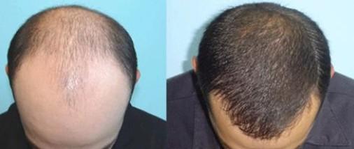 深圳哪家公立整形醫(yī)院好？本地人廣受推崇的前六名推薦