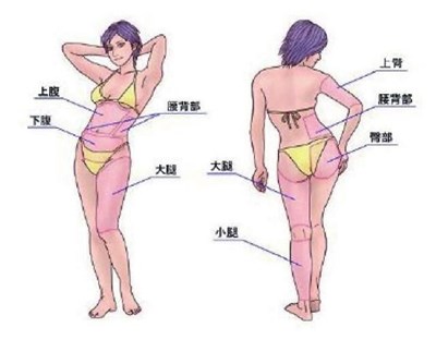 南京消除生長紋術(shù)醫(yī)生