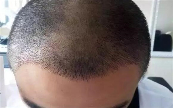 湛江整形醫(yī)院排名前十，華美、博愛、美聯(lián)致美等入選！詳細介紹醫(yī)院背景及特色！