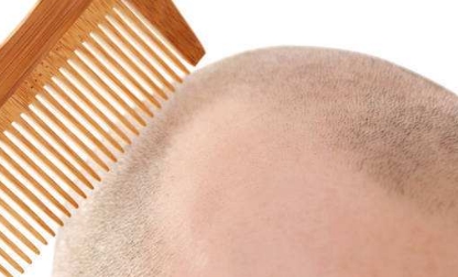 滄州市哪家醫(yī)院的隆鼻整形技術(shù)最實(shí)力？排行榜公布！