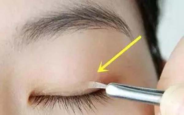 汕頭植發(fā)醫(yī)院排行榜前六：雍禾稱霸！曙光、華美也上榜！快來了解一下吧