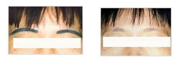 沈陽(yáng)七家拉皮手術(shù)一流，用戶(hù)評(píng)價(jià)方法巧妙