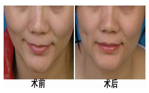 溫州整形行業(yè)揭秘！頂級醫(yī)院曝光，藝星、星范露真面目，領(lǐng)先三家！