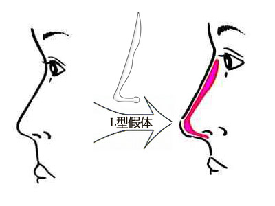 深圳最佳激光脫毛整形醫(yī)院推薦-公立醫(yī)院領(lǐng)跑市場(chǎng)！