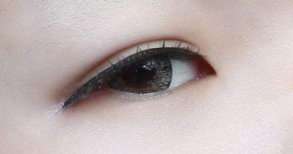 沈陽玻尿酸去皺中心：2023新評選揭曉！這幾間去頸紋醫(yī)院值得考慮嗎？快來查看一下！