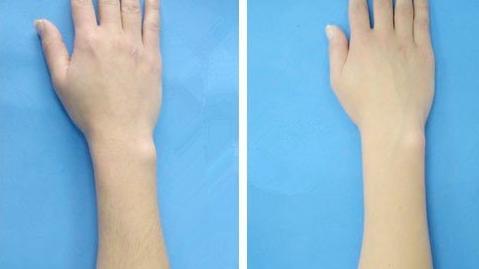 泰安斑點(diǎn)治療醫(yī)院排行榜：選擇這些醫(yī)院，讓斑點(diǎn)不再遮擋你的美麗~