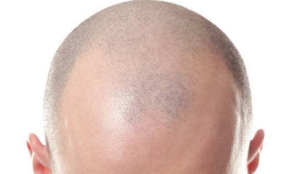 汕頭2023年微創(chuàng)整形醫(yī)院好評(píng)榜單前六名：伊麗莎白、華美、曙光脫穎而出！