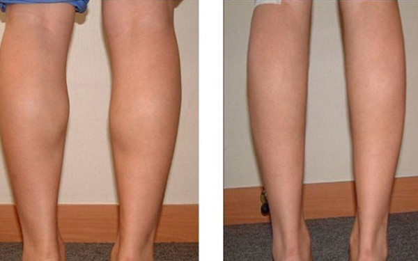 珠海哪里有好的雙眼皮醫(yī)院？推薦幾家備受好評的醫(yī)院！