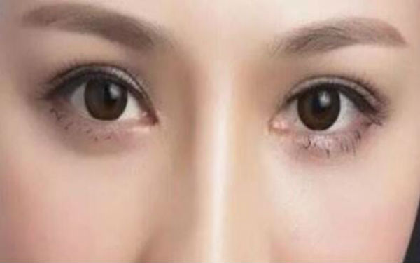 邯鄲割雙眼皮醫(yī)院排行榜TOP5——萊媚儷與德枝美，你需要看看