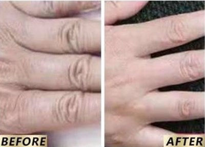 西安哪家整形醫(yī)院綜合實(shí)力強(qiáng)，口碑好！米蘭柏羽榜首完勝！