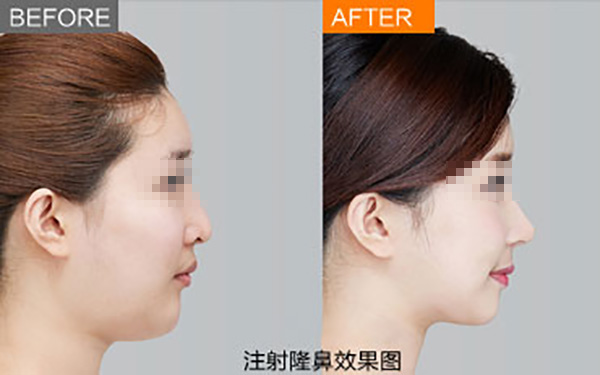 鄭州唇部整形醫(yī)院推薦：如何選擇合適的醫(yī)院？友友必看！