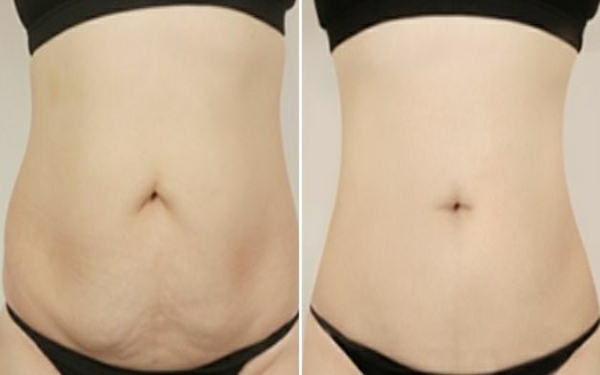 貴陽最受歡迎的雙眼皮手術(shù)機構(gòu)大揭秘，你一定不能錯過！