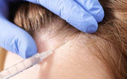 祛斑醫(yī)院推薦：打破斑點(diǎn)煩惱，找回美麗肌膚