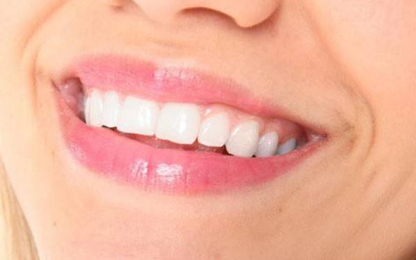 西藏雙眼皮手術(shù)挑選指南，暢享自然美麗眼瞳