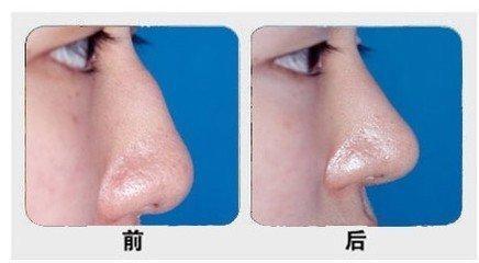 石家莊主要公立整形醫(yī)院排行榜！公辦醫(yī)療機(jī)構(gòu)最具實(shí)力！