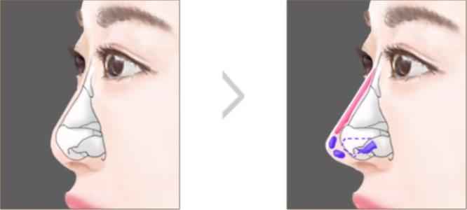 西安整形美容醫(yī)院推薦top4大揭秘！從西美到時(shí)光，最佳選擇一覽無(wú)余！